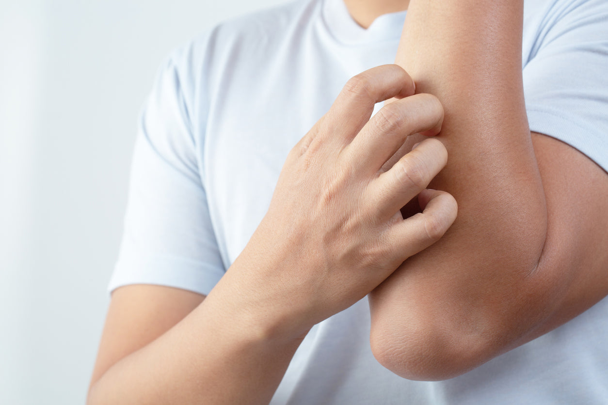 Man with dry skin scratching his arm